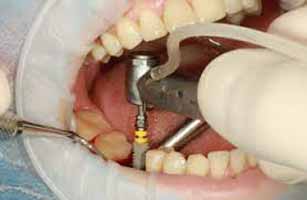 دندانپزشکی در گراب سفلی