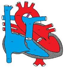 تشخیص آریتمی قلبی
