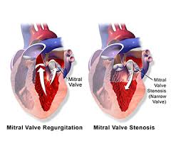 شایع ترین بیماری های قلبی pdf