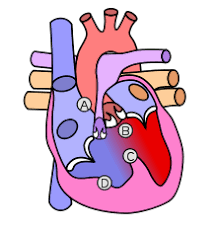 مراقبت بعد از آنژیوگرافی قلب چیست