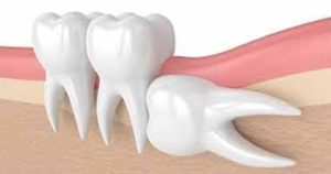 اموزش دستیار دندانپزشکی در شیراز