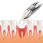 بهترین دکتر دندانپزشکی اطفال در خرم آباد