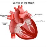 آنژیوگرافی قلب نوزاد نی نی سایت