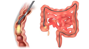 دکتر فوق تخصص گوارش در کاشان