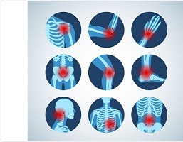 فوق تخصص روماتولوژی در سقز