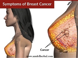 best breast cancer surgeon in pittsburgh