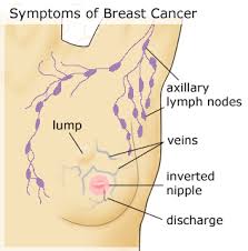 best breast cancer surgeon in va