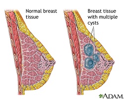 breast cancer surgeon knoxville tn