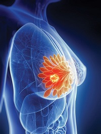 breast cancer surgeon las vegas