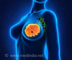 breast cancer surgeon orange county