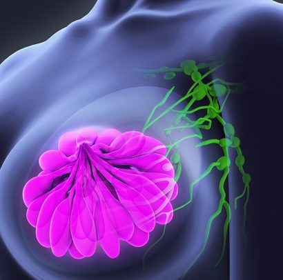 breast cancer surgeon san diego