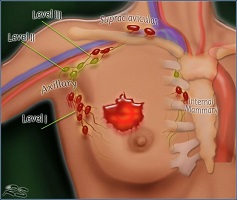 i’m a breast cancer surgeon. here’s what i think of the new screening guidelines