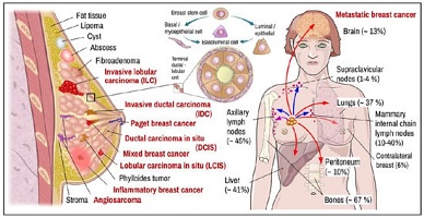 oncologist surgeon breast cancer