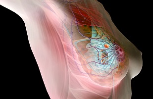 questions to ask your surgeon after breast cancer surgery