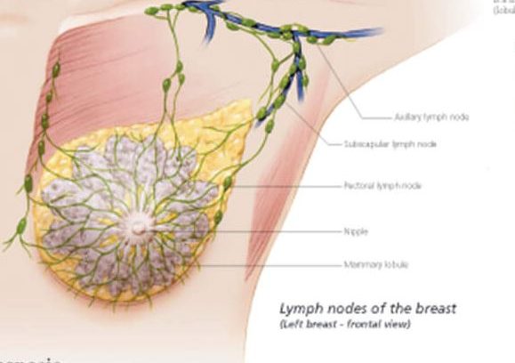 stomach cancer surgeon accident