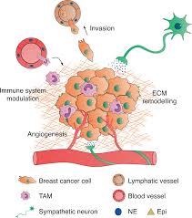 stomach cancer surgeon ğp