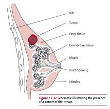 stomach cancer surgeon researchgate